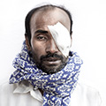 Mr Jober Ali, 45, manda naogaon, farmer, eye operation two days ago